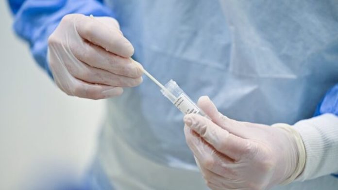 PCRtest-brazilvariantAFP1 (1)