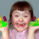 sindrome de Down