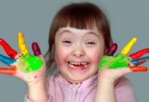 sindrome de Down