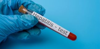 Hepatitis