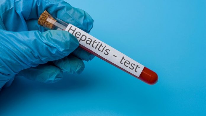 Hepatitis