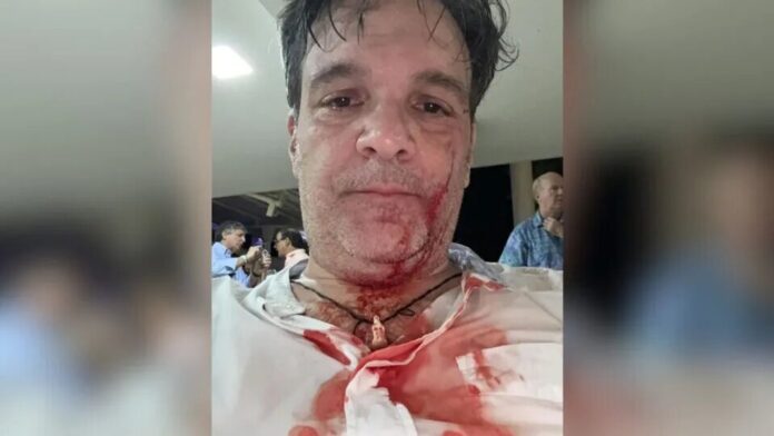 altercado entre Cusanno y Calcaño