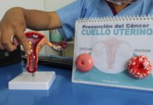 Cáncer de cuello uterino