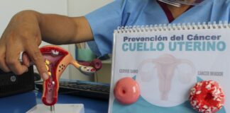 Cáncer de cuello uterino