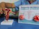 Cáncer de cuello uterino