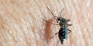 ¿Cómo diferenciar el dengue, zika y chikungunya?