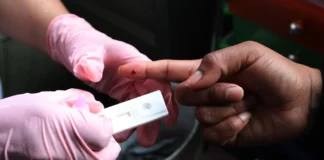 Casi 40 % de las personas con VIH en Venezuela desconoce su diagnóstico