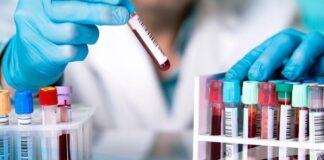 Persiste el 80 % de la falta de insumos en los laboratorios públicos